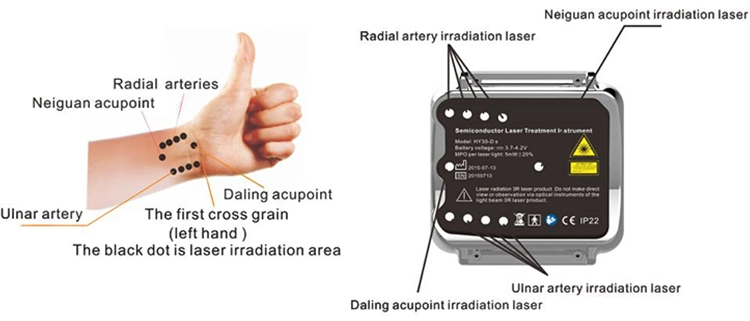 Wrist 650nm Diode Laser High Pressure Cleaning Machine